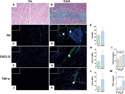 Enhanced Migratory Capacity of T Lymphocytes in Severe Chagasic Patients Is Correlated With VLA-4 and TNF-α Expression